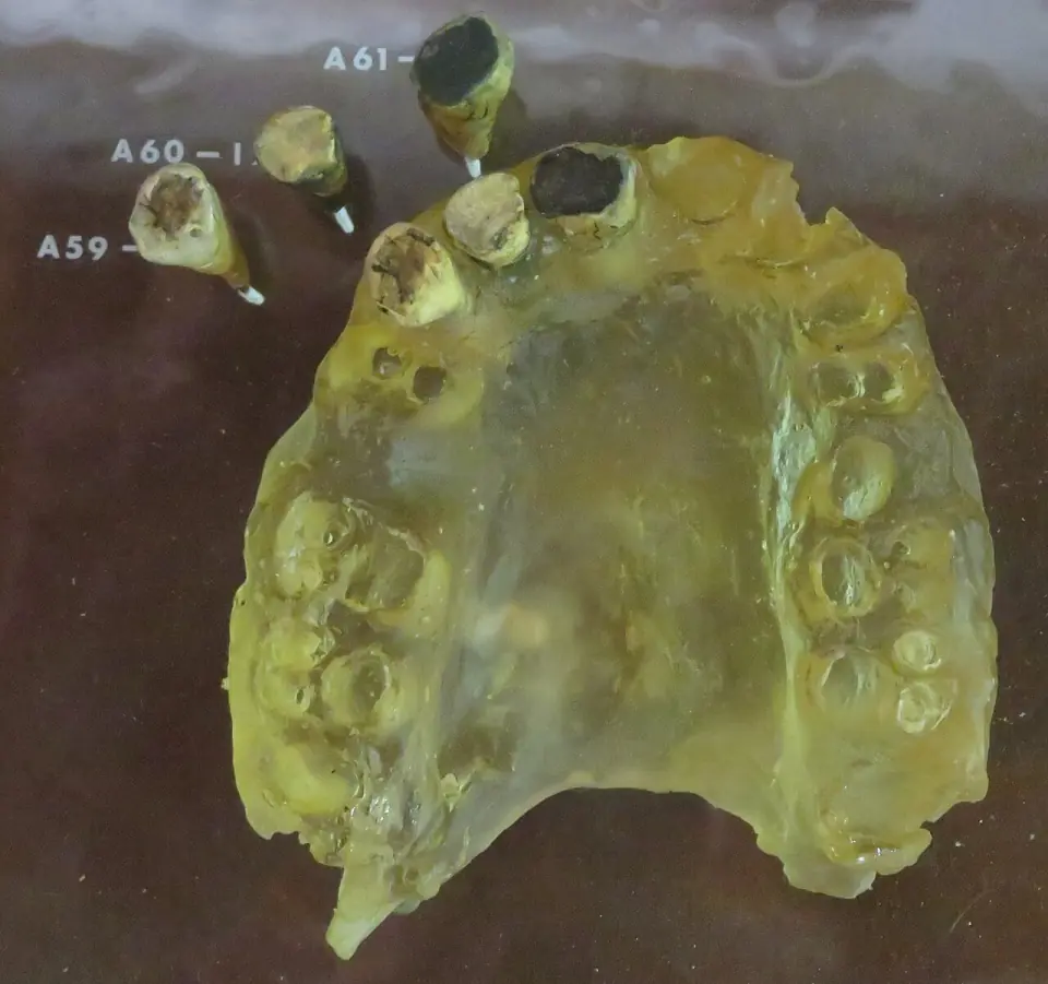 Réplique du fossile Arago 14, Homo heidelbergensis de Tautavel, exposée au musée